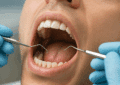 cbd et douleur dentaire